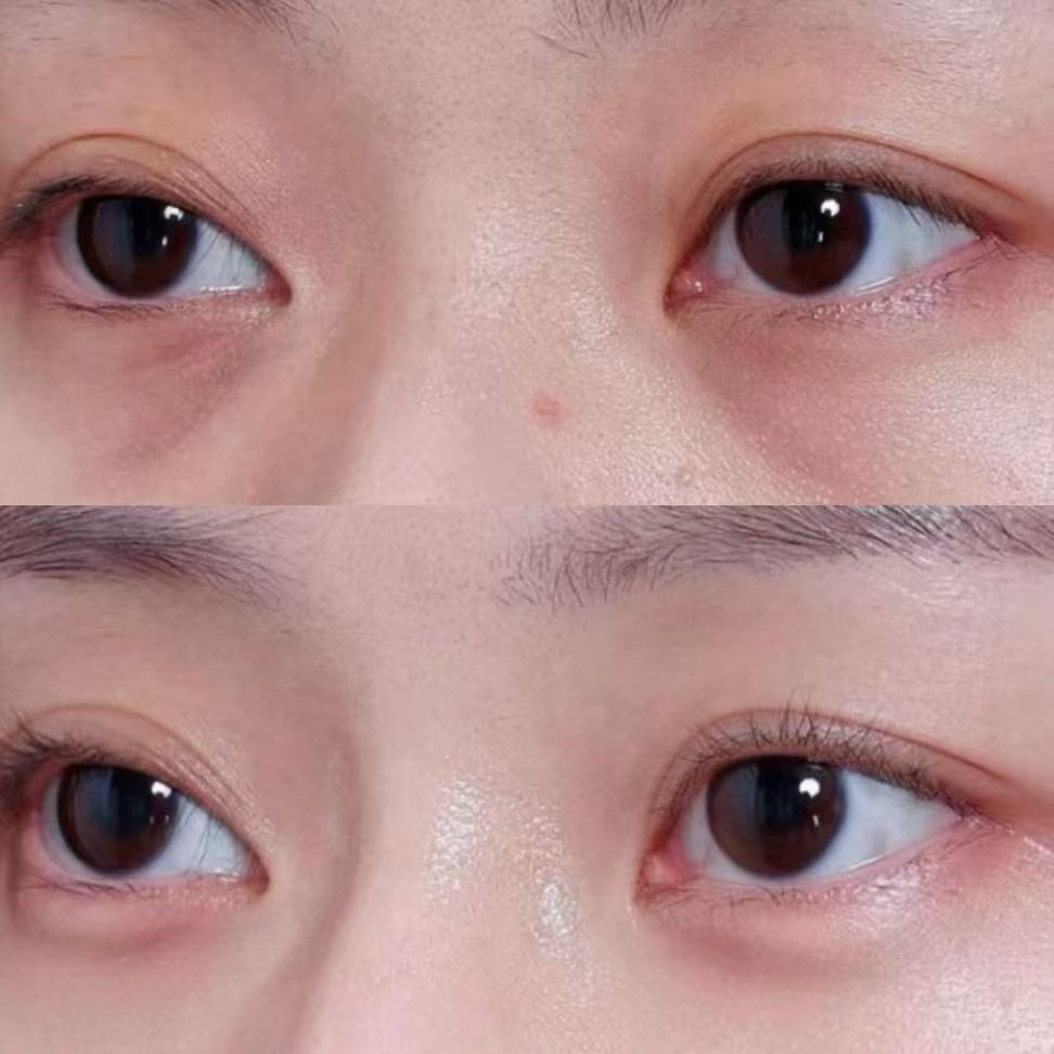 Tear Trough Rescue Set — Herbal Compress & Ebony Gua Sha Wand